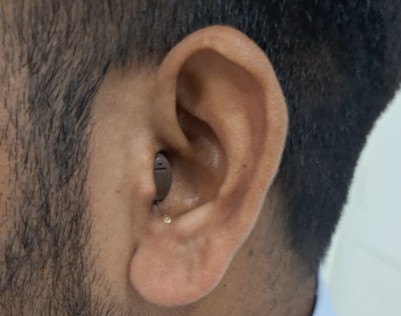 Hearing Aid Repair and Service Faridabad